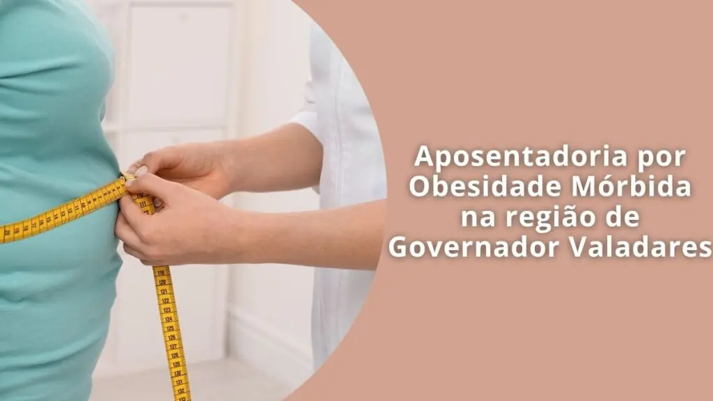 Aposentadoria por Obesidade Mórbida na região de Governador Valadares